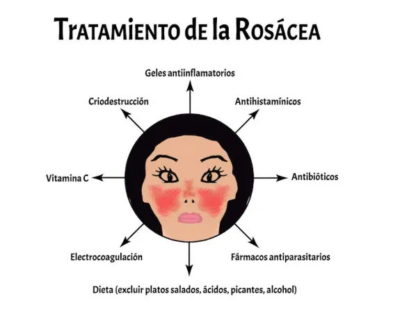 Tratamiento de la rosácea – Dr. Cruces Prado, Pontevedra